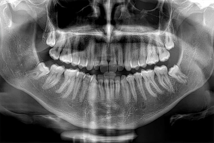 radiologia dentale OPT-Clinica-Odontoiatrica-Risita