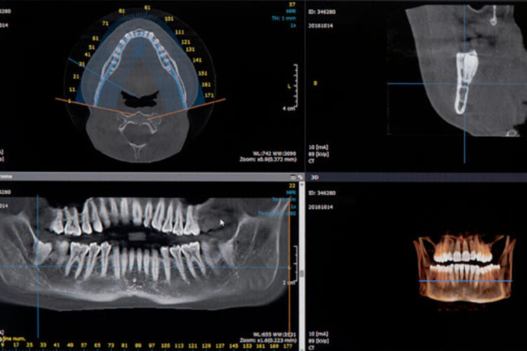 TC Cone Beam Clinica-odontoiatrica-Risita